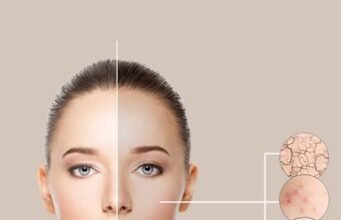 Glutathione Injection for Skin Brightening in Dubai: Cost, Results & FAQs Gultathione injection