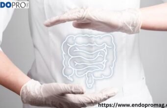 Gastrointestinal Disorders Treatment to Improve Gut Health Fast Gastrointestinal Disorders Treatment