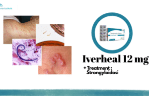 Parasitic Infections: Causes, Symptoms & Effective Treatments Iverheal 12 mg