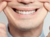 The Psychology of Smiling: Why a Healthy Smile Changes Everything