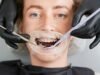 Teeth Gap Filling Costs in Marlow: What You Need to Know Teeth gap filling