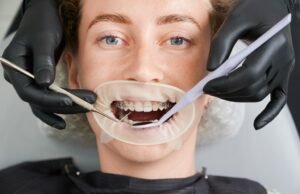 Teeth Gap Filling Costs in Marlow: What You Need to Know Teeth gap filling
