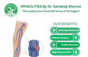 Your Guide to Modern Varicose Veins Treatment in India: Find Relief & Confidence