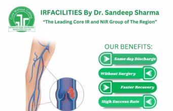 Your Guide to Modern Varicose Veins Treatment in India: Find Relief & Confidence