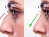 Why More People Are Choosing the Best Rhinoplasty in Islamabad for Nose Enhancement best rhinoplasty in islamabad