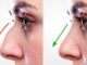 Why More People Are Choosing the Best Rhinoplasty in Islamabad for Nose Enhancement best rhinoplasty in islamabad