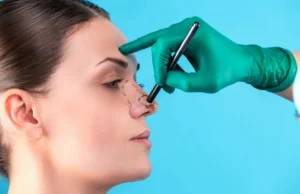 Your Guide to Making Smart Choices for Nose Surgery in India Nose Surgery