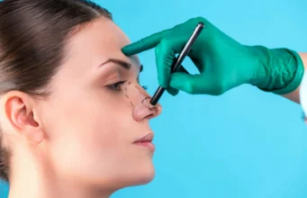 Your Guide to Making Smart Choices for Nose Surgery in India Nose Surgery