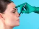 Your Guide to Making Smart Choices for Nose Surgery in India Nose Surgery
