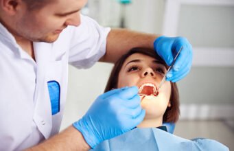 Before and After: Real Results from Cosmetic Dentistry in Cypress