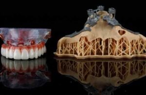 Why More Patients Are Choosing Local Smile Clinics in Glasgow Dental Appointment