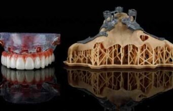 Why More Patients Are Choosing Local Smile Clinics in Glasgow Dental Appointment