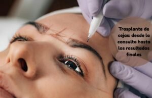 Trasplante de cejas: desde la consulta hasta los resultados finales trasplante de cejas