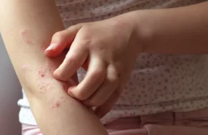 Wormentel 444mg – One-Dose Treatment for Intestinal Parasites Wormentel 444mg Tablets