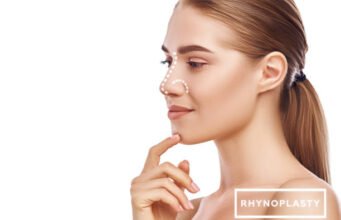 What’s the Ideal Nose Shape? Exploring Aesthetics in Rhinoplasty Surgery Rhinoplasty surgery in Riyadh